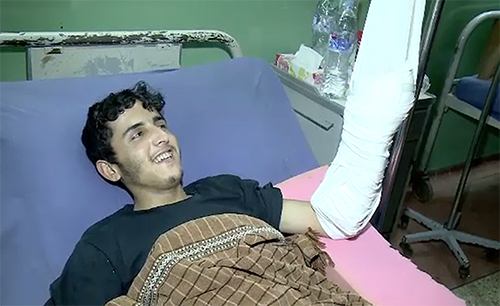 حیات آباد میڈیکل کمپلیکس میں ڈاکٹرز نے نوجوان کا کٹا ہوا ہاتھ جوڑ دیا