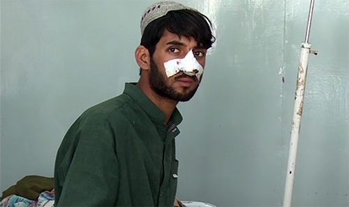 راولپنڈی میں کانگو کا مریض دم توڑ گیا‘ 25 مشتبہ مریض آئسولیشن وارڈ شفٹ