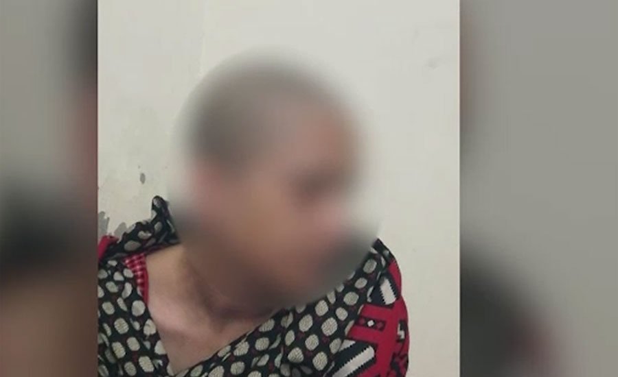 لاہور ، کاہنہ میں شوہر کے ہاتھوں تشدد کا نشانہ بننے والی خاتون پر تشدد ثابت ہو گیا