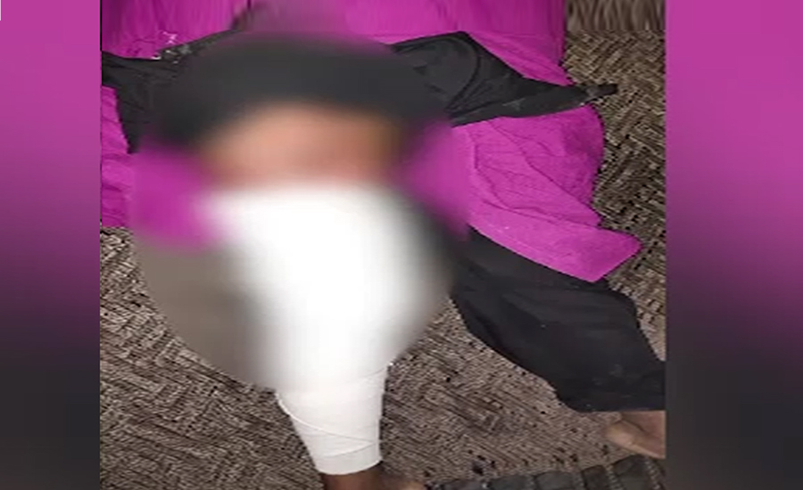 شیخ زاید اسپتال رحیم یار خان میں کینٹین مالک نے بچے پر کھولتا پانی انڈیل دیا