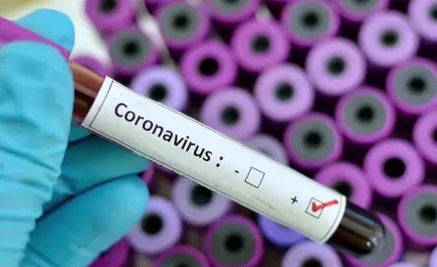 پاکستان میں کورونا وائرس کا پہلا مریض جاں بحق