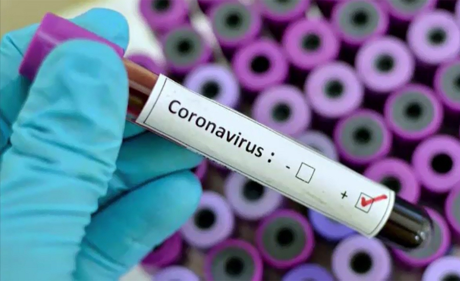 کورونا وائرس نے اٹلی میں مزید 601 افراد کی جان لے لی