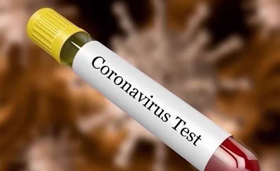 کورونا وائرس کے باعث گزشتہ 24 گھنٹے میں صرف 6 اموات ریکارڈ