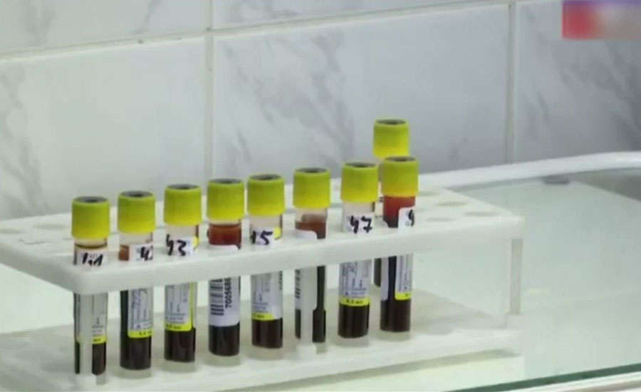 روس نے کورونا وائرس کیخلاف دنیا کی پہلی ویکسین تیار کرلی